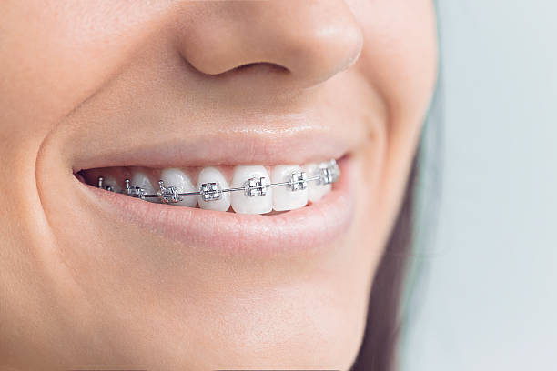 Best Full Mouth Reconstruction  in Gladeview, FL